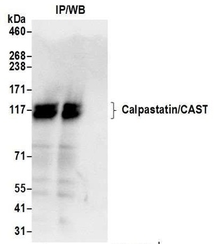 Rabbit anti-Calpastatin/CAST Antibody