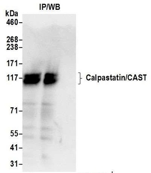 Calpastatin/CAST Antibody