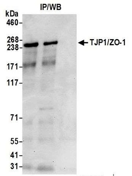 TJP1/ZO-1 Antibody