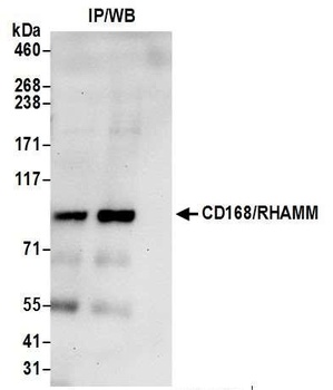 Rabbit CD168/RHAMM Antibody