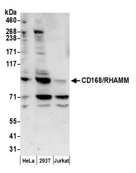 Rabbit CD168/RHAMM Antibody