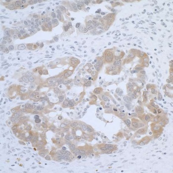 Rabbit anti-CBS Antibody