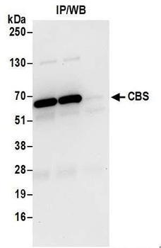 Rabbit anti-CBS Antibody