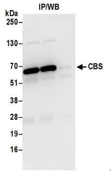 CBS Antibody