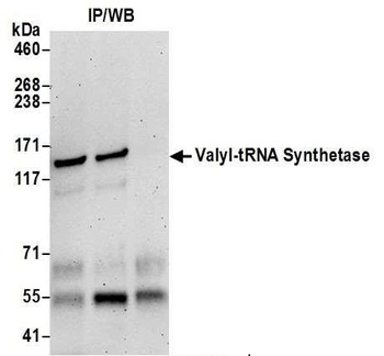 Valyl-tRNA Synthetase/VARS Antibody