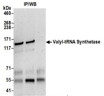 Rabbit anti-Valyl-tRNA Synthetase/VARS Antibody