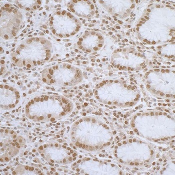 Rabbit anti-ELAC2 Antibody