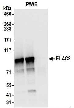 Rabbit anti-ELAC2 Antibody