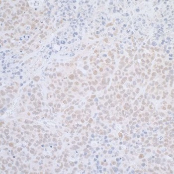 Rabbit anti-ELAC2 Antibody