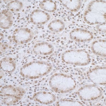 Rabbit anti-ELAC2 Antibody