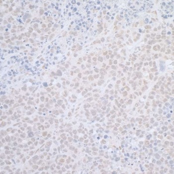 Rabbit anti-ELAC2 Antibody