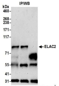 ELAC2 Antibody