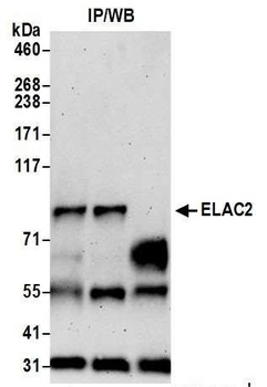 Rabbit anti-ELAC2 Antibody
