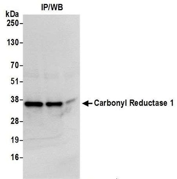 Carbonyl Reductase 1/CBR1 Antibody