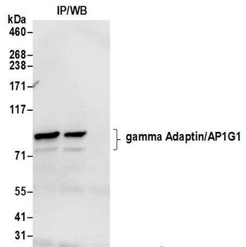 gamma Adaptin/AP1G1 Antibody