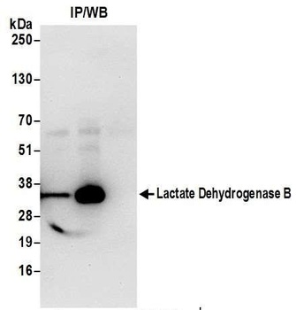 Lactate Dehydrogenase B/LDHB Antibody