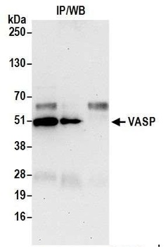 Rabbit VASP Antibody
