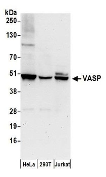 Rabbit VASP Antibody