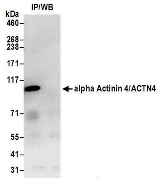 alpha Actinin 4/ACTN4 Antibody