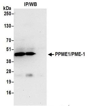 PPME1/PME-1 Antibody