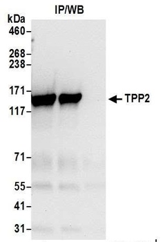 TPP2 Antibody