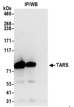 TARS Antibody