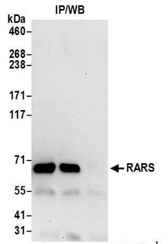Rabbit RARS Antibody