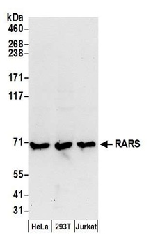 Rabbit RARS Antibody