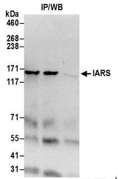 IARS Antibody