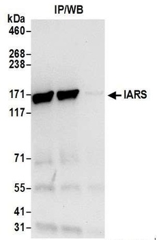 IARS Antibody