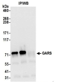 Rabbit GARS Antibody