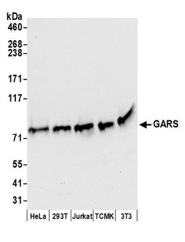 Rabbit GARS Antibody