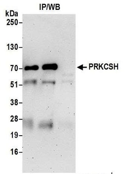 PRKCSH Antibody