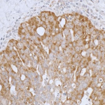 Rabbit anti-Peroxiredoxin-3 Antibody