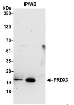 Rabbit anti-Peroxiredoxin-3 Antibody