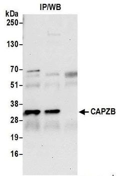 CAPZB Antibody