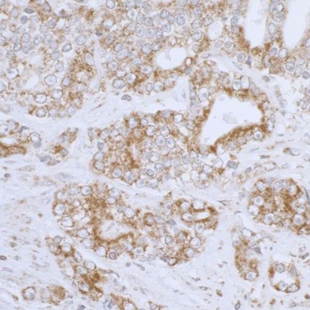 Rabbit anti-DLD Antibody