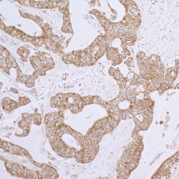 Rabbit anti-DLD Antibody