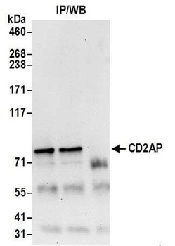 CD2AP Antibody