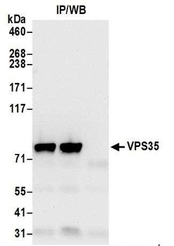 VPS35 Antibody