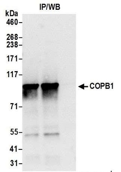Rabbit anti-COPB1 Antibody