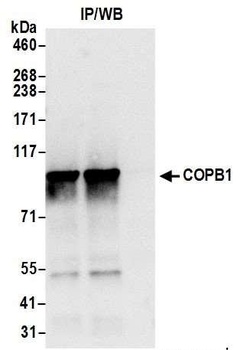 COPB1 Antibody