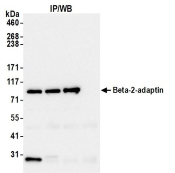 Beta-2-adaptin Antibody