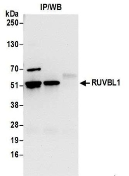 Rabbit anti-RUVBL1 Antibody