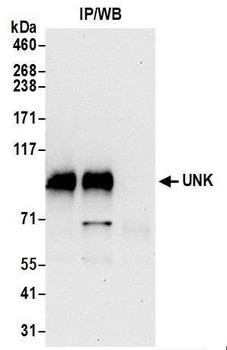 UNK Antibody