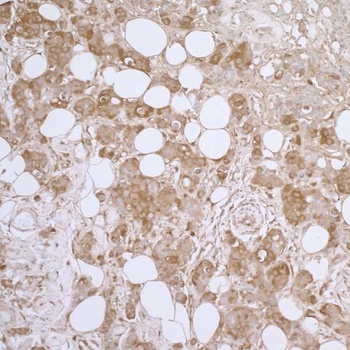 Rabbit anti-HSP27 Antibody