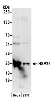 Rabbit anti-HSP27 Antibody