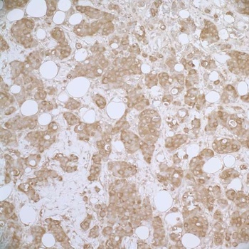 Rabbit anti-HSP27 Antibody