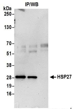 HSP27 Antibody