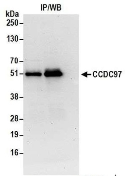 Rabbit anti-CCDC97 Antibody